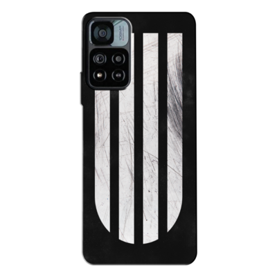 Xiaomi - Redmi Note 11 Pro Plus 5G Zebra Silikon Kılıf