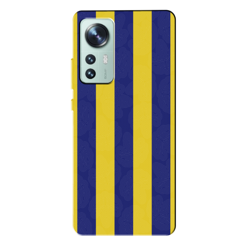 Xiaomi - Mi 12 Çubuklu Silikon Kılıf