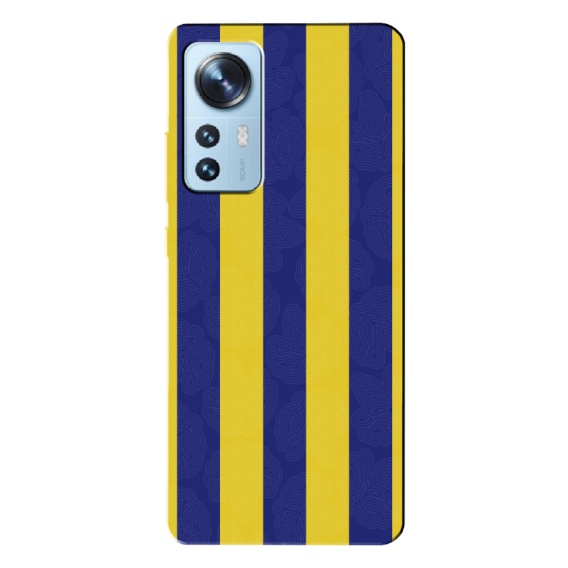 Xiaomi - Mi 12 Pro Çubuklu Silikon Kılıf