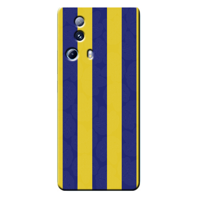 Xiaomi - Mi 13 Lite Çubuklu Silikon Kılıf