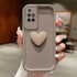 Xiaomi - Redmi 10 Zebana Amour Silikon Kılıf - Kahverengi
