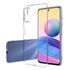 Xiaomi - Redmi Note 10 5G Zebana Şeffaf Soft Silikon Kılıf - Şeffaf