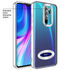 Xiaomi - Redmi Note 8 Pro Zebana Glint Silikon Kılıf - Gri