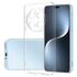 Honor - Magic 7 Pro Zebana Şeffaf Soft Silikon Kılıf - Şeffaf